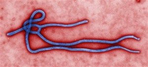 This image from the Centers for Disease Control shows the Ebola virus. Two people in Utah are being monitored for signs they may have carried the virus from Africa. (Associated Press)